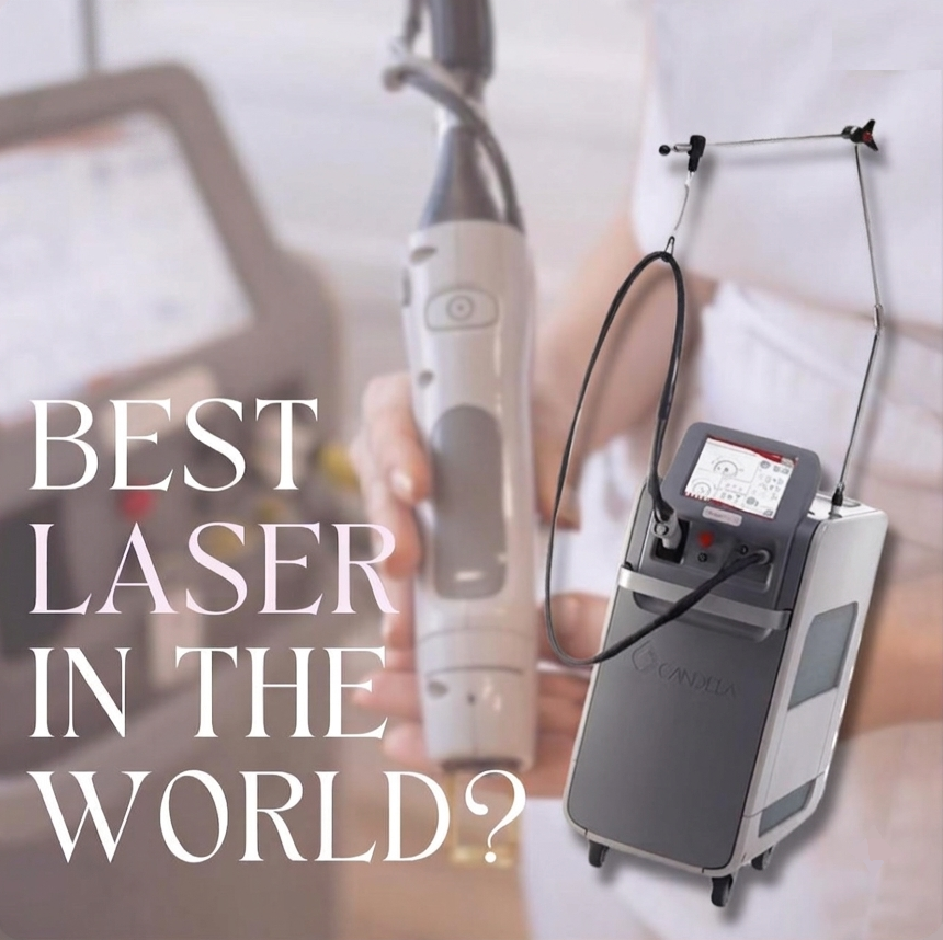 Αποτρίχωση Laser Alexandrite