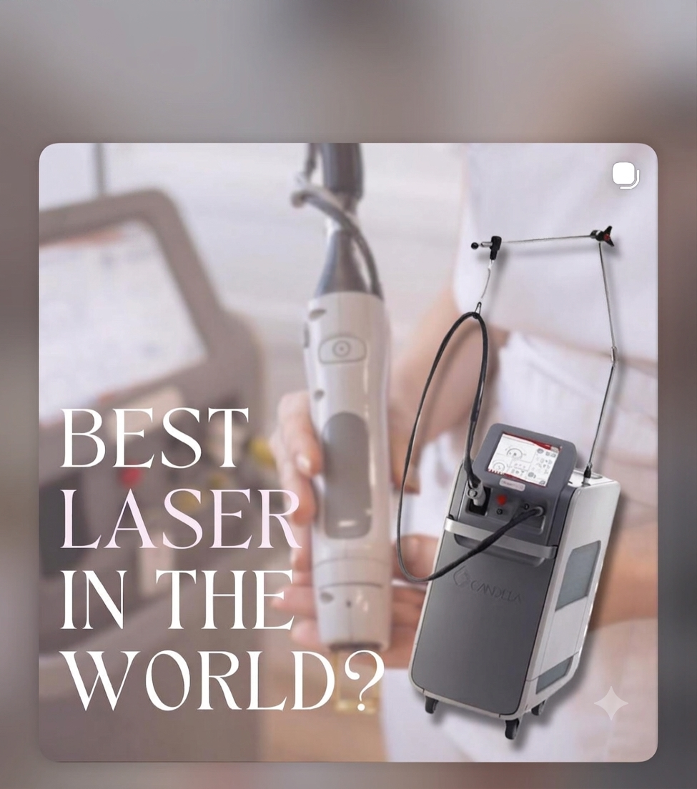 Αποτρίχωση Laser Alexandrite